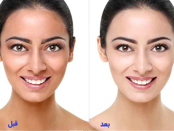 انواع کرم روشن کننده پوست برند Katrin حجم ۱۱۵ گرم